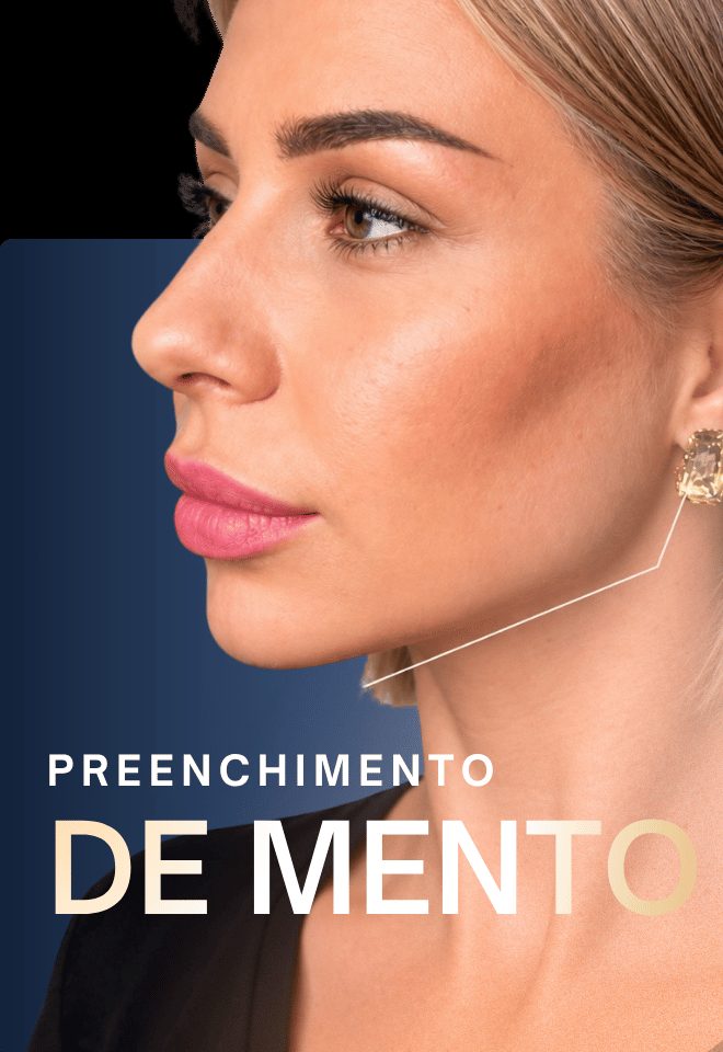 Preenchimento de mento