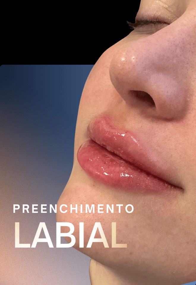 Preenchimento labial
