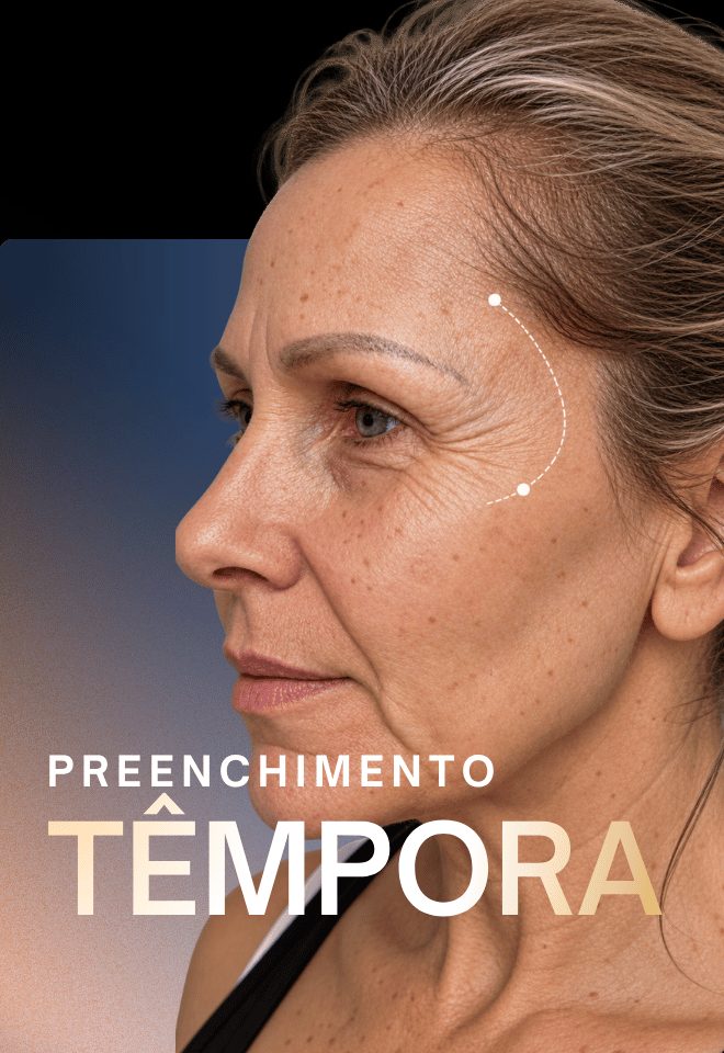 Preenchimento de têmpora